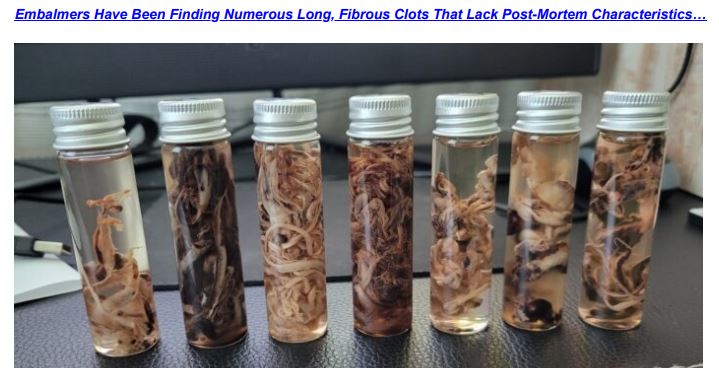 https://twpter.com/users/cali/feed/2022-0907-0721-2319-f-cali.pdf -   PDF: More Embalmers Speak Out About Abnormal Blood Clots Found In Recently Deceased…. _ Political Talk                  Just more evidence that the spike proteins produced by the MRNA altering   #COVID  #vaccine are causing premature death.            The only question I have is: Was this just lack of research into the safety of this experimental gene therapy injection (can't call it a vaccine), or was it intentional as in a program of population control or population reduction?             #BillGates out of context? Really?            https://www.google.com/search?q=bill+gates+population+control+with+vaccines                               #ArchivePDF       
